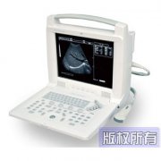 V5全数字便携式兽用B超机